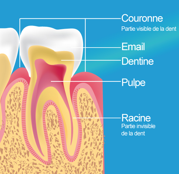 dentiste bron dévitalisation traitement endodontique